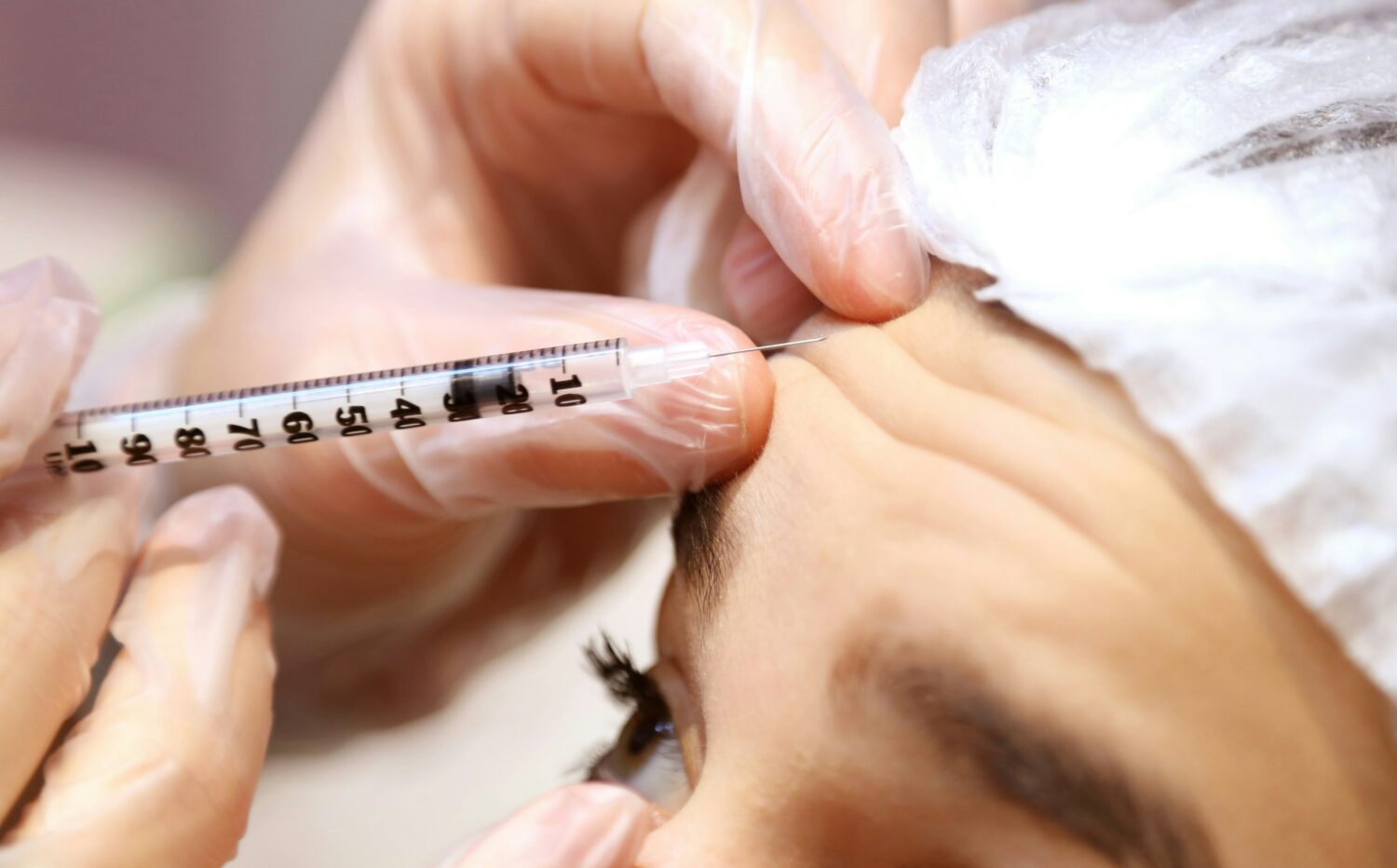 best botox and filler injector near bellevue, lake sammamish issaquah wa