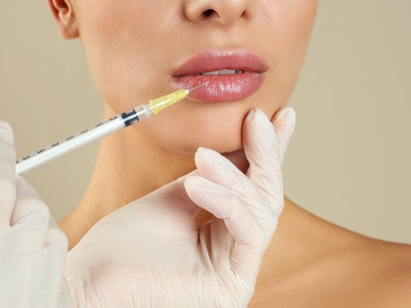 best lip filler seattle