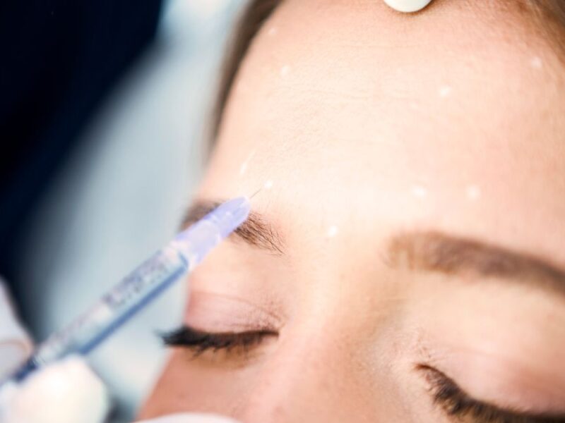 baby botox seattle