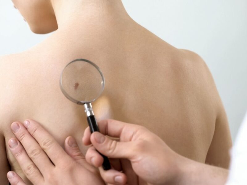 dermatologist bellevue wa