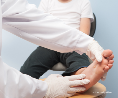 Wart Removal in Issaquah, WA: What You Should Know